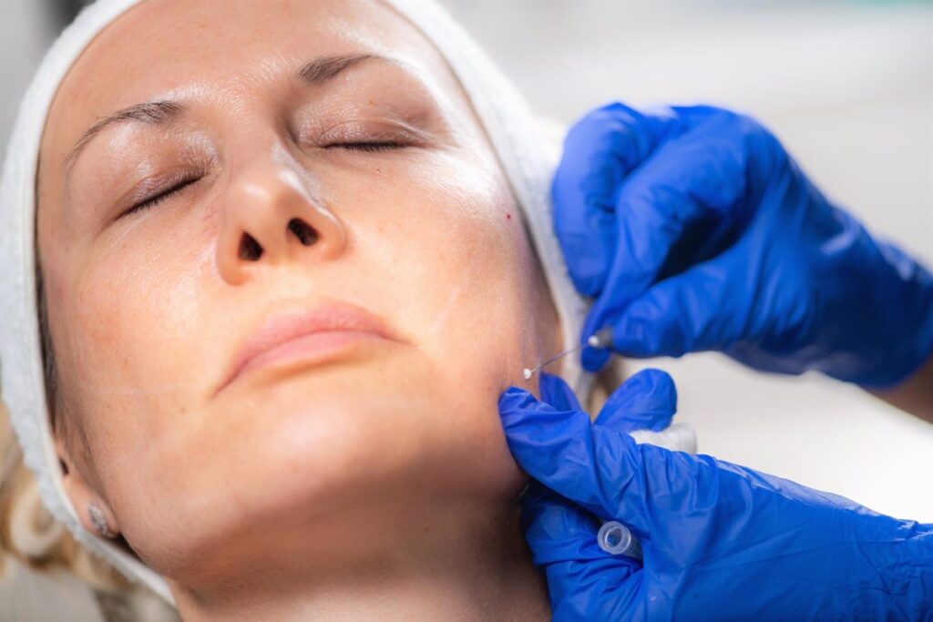 Experta recomienda los hilos tensores faciales para conseguir un efecto lifting, "sin los riesgos de la cirugía"